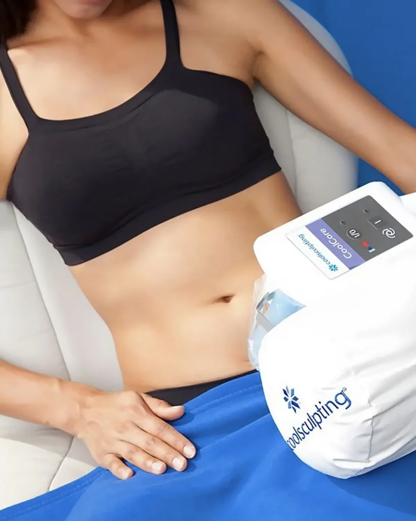 CoolSculpting